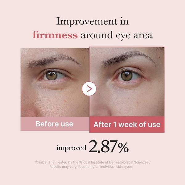 Medicube PDRN Pink Peptide Eye Cream 30ml Secondary image