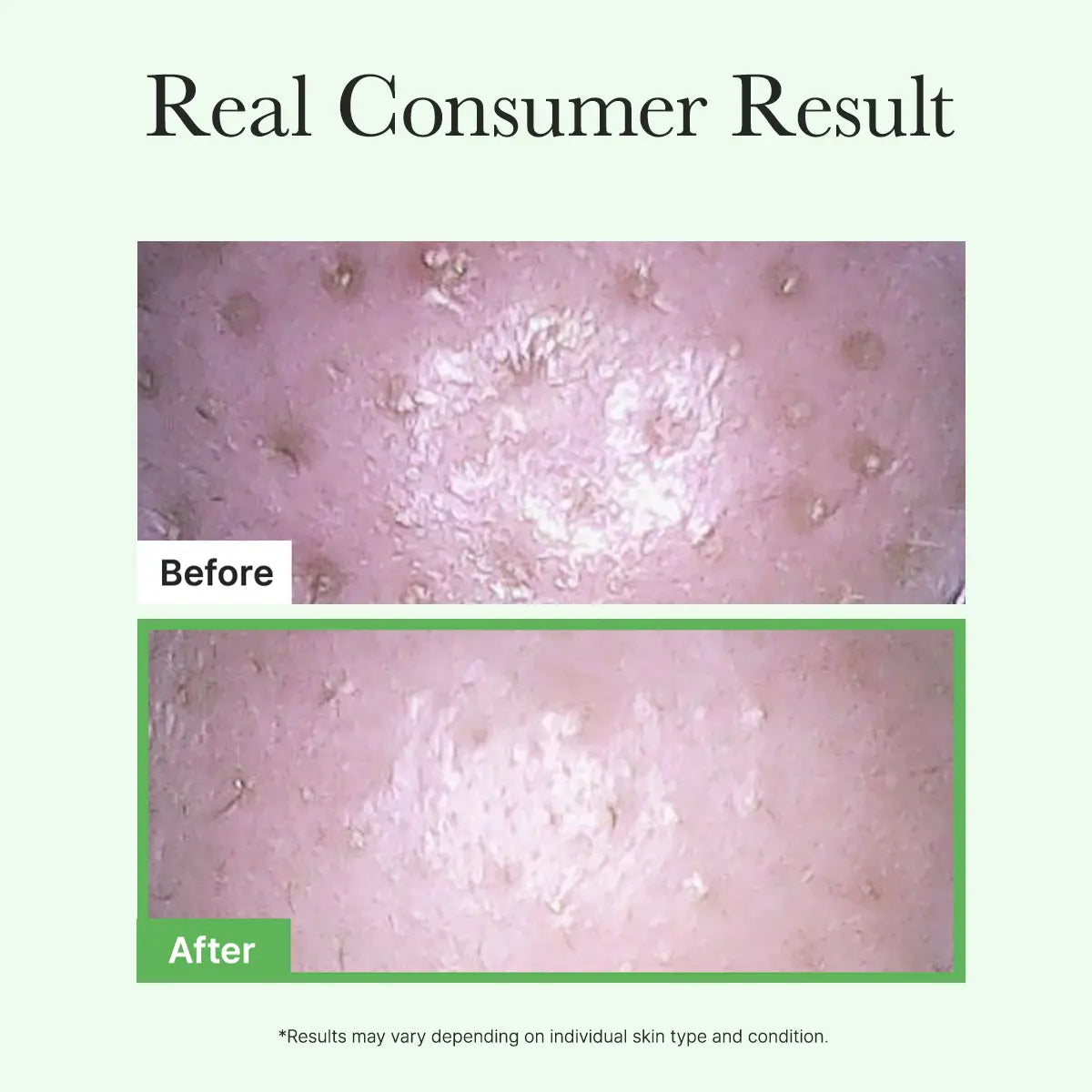Arencia Pore Melt Mochi Cleansing oil Secondary image