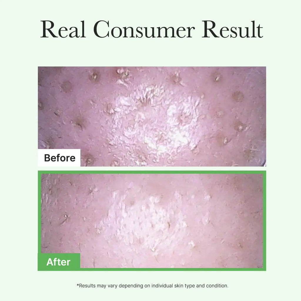 Arencia Pore Melt Mochi Cleansing oil