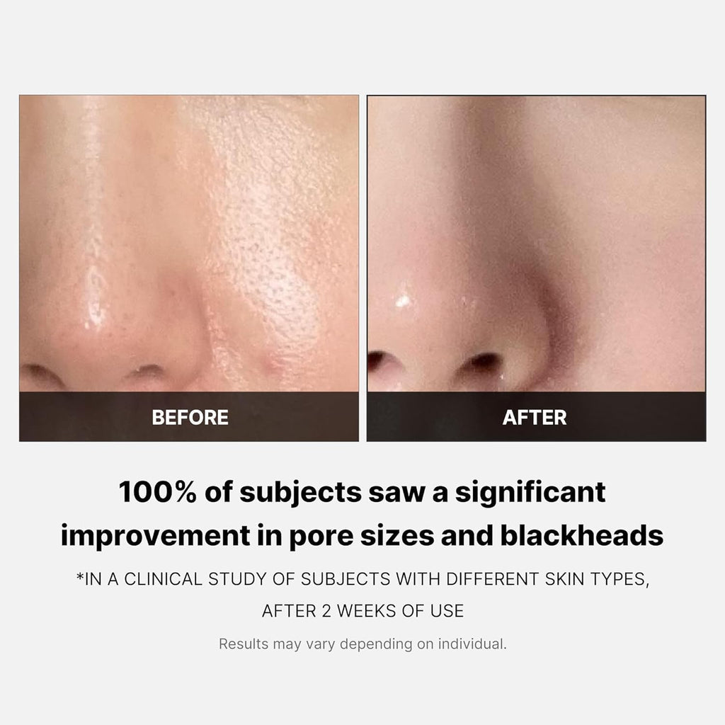 Medicube Zero Pore Pad 2.0 155g