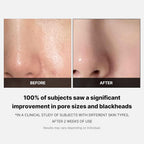 Medicube Zero Pore Pad 2.0 155g