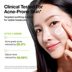 ANUA Azelaic Acid Cica Skin Soothing Moisturizer 100ML