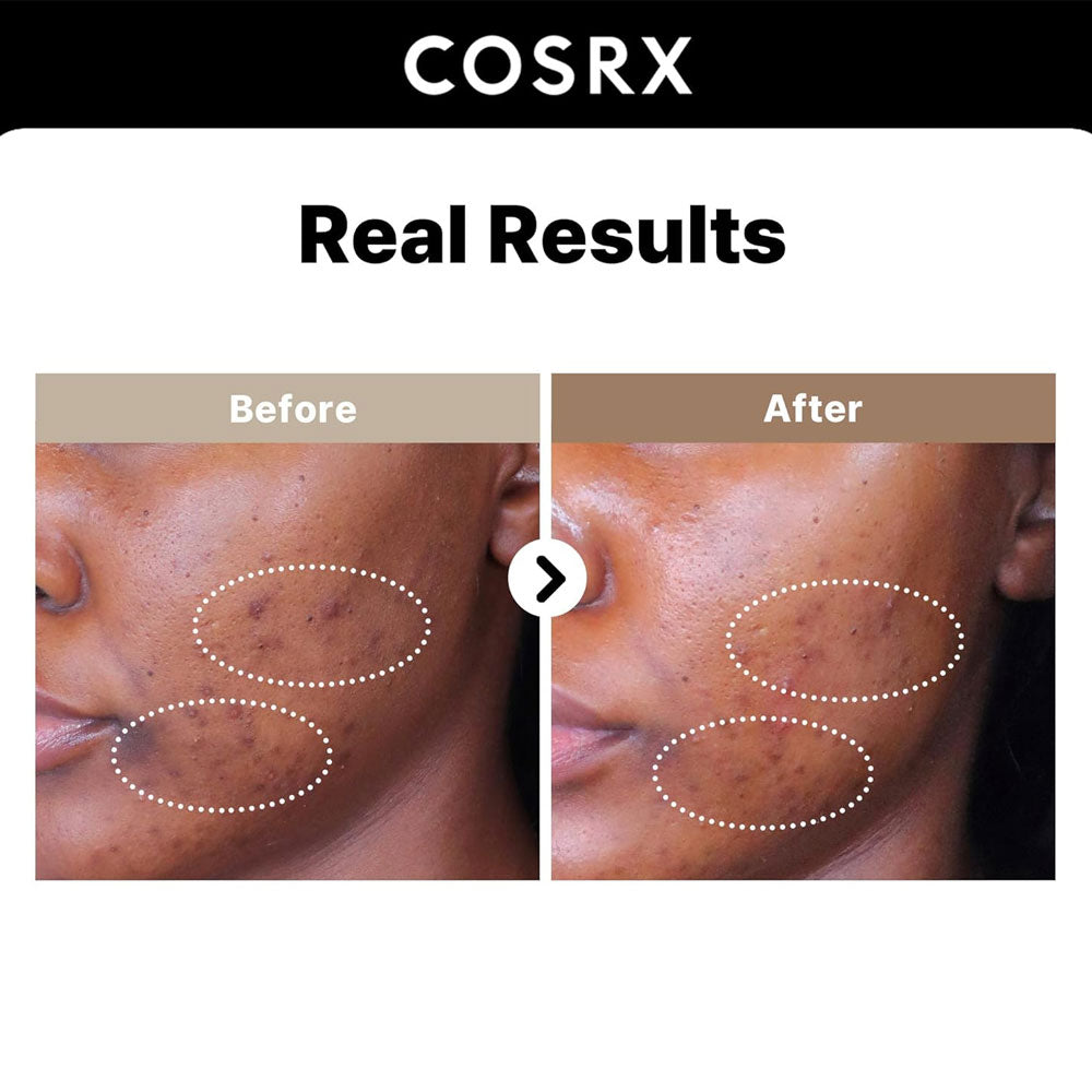 COSRX - The Alpha-Arbutin 2 Discoloration Care Serum - 50ml Secondary image