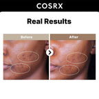 COSRX - The Alpha-Arbutin 2 Discoloration Care Serum - 50ml
